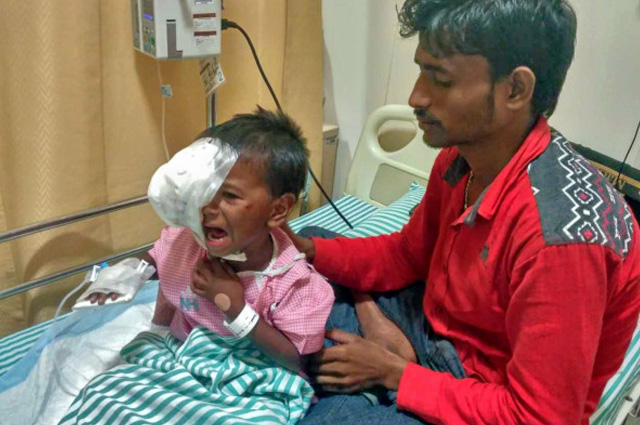 Help this 4 year old girl Puthul Kumari Paswanwho is the daughter of a farmer is now diagnosed with a severe eye cancer called Neuroblastoma in India. Your Donation will save this precoius life.